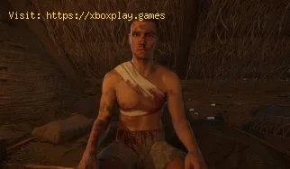So heilen Sie in Kingdom Come Deliverance 2